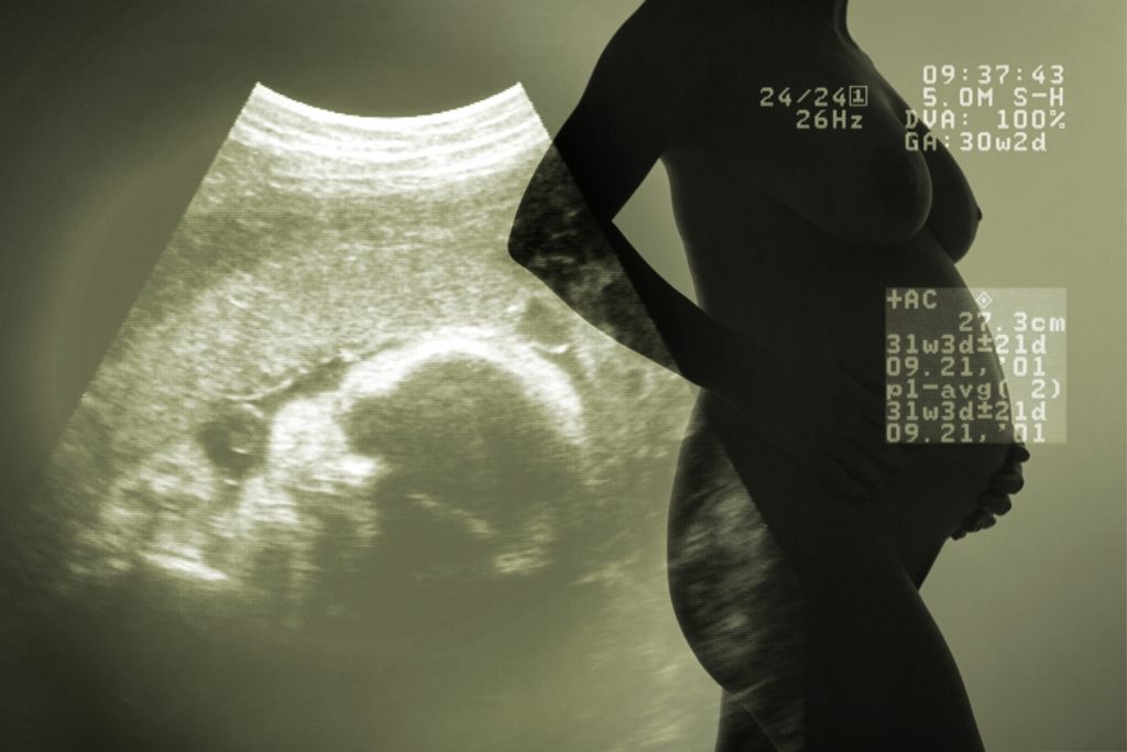 Acupuntura infertilidad medicina china